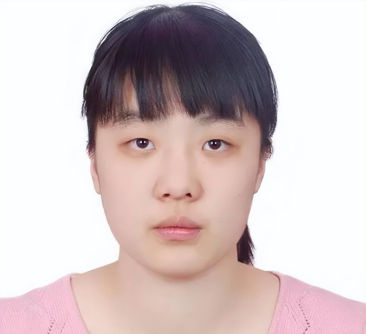 鼻子如何缩小_缩小鼻子毛孔用什么药_缩小鼻子毛孔